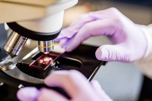 slide on a microscope